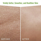 Wild Naturals Moisturizing Eczema Body Wash – Gentle Psoriasis Body Wash for Itchy, Dry Skin Relief – Eczema Soap for Redness and Flareups – Hydrating Cleanser for Women and Men