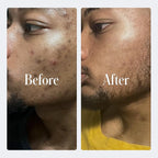 Geologie Complete Skincare Set for Men & Women | 1-Month Simple & Effective Daily Clear Skin Routine | Acne, Oily Skin, Dark Spots | Face Wash 2-Pack, Retinol Face Cream, SPF15 Moisturizer & Eye Cream