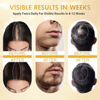 Minoxidil for Men and Women, Hair Growth Biotin Serum with Batana and Rosemary for Hair Beard Regrowth Treatments Extra Strength Hair Loss Solution, Clinically Proven to Regrow Thicker