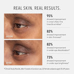 HydroPeptide Retinol Eye Renewal Lifting & Firming Eye Balm with 0.65% Universal Tri-Retinol Complex Peptide Solution, 0.5 Ounce