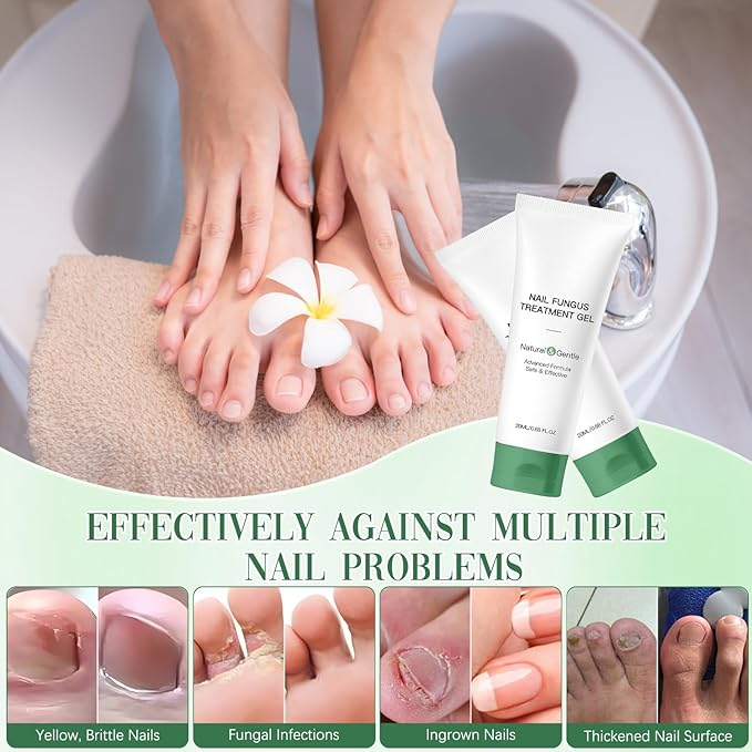 2PCS Nail Repair Gel – Multi-Purpose Nail Repair, Nail Growth Serum for Damaged Nail