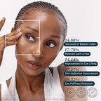 Re.SPN Bakuchiol Firming Eye Cream with Cooling Metal Roller – Clinically Proven Moisturizing Eye Cream for Puffiness, Wrinkles & Dark Circles | Vegan, Fragrance-Free, Korean Skincare (0.67 fl oz)