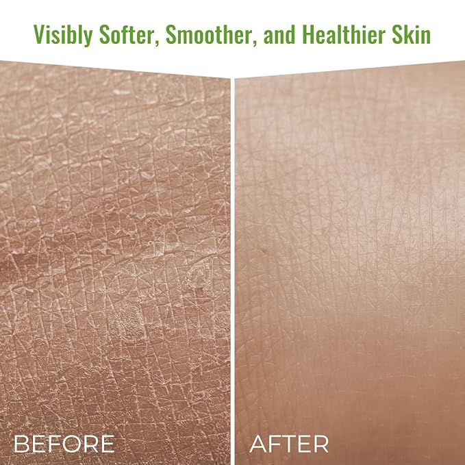 Wild Naturals Moisturizing Eczema Body Wash – Gentle Psoriasis Body Wash for Itchy, Dry Skin Relief – Eczema Soap for Redness and Flareups – Hydrating Cleanser for Women and Men