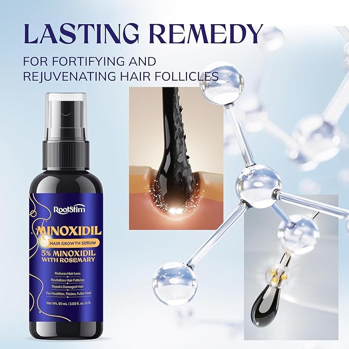 5% Minoxidil Hair Growth for Men and Women: Extra Strength Minoxidil Hair Loss Treatment Serum with Rosemary for Faster Stronger Thicker Hair Growth 2 FL OZ