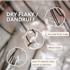 Aromase Dry Scalp Soothing Shampoo - Hydrates, Relieves Dryness and Itchiness - Amino Acid-Based Formula - No Parabens, SLS, or Silicone - 14 oz