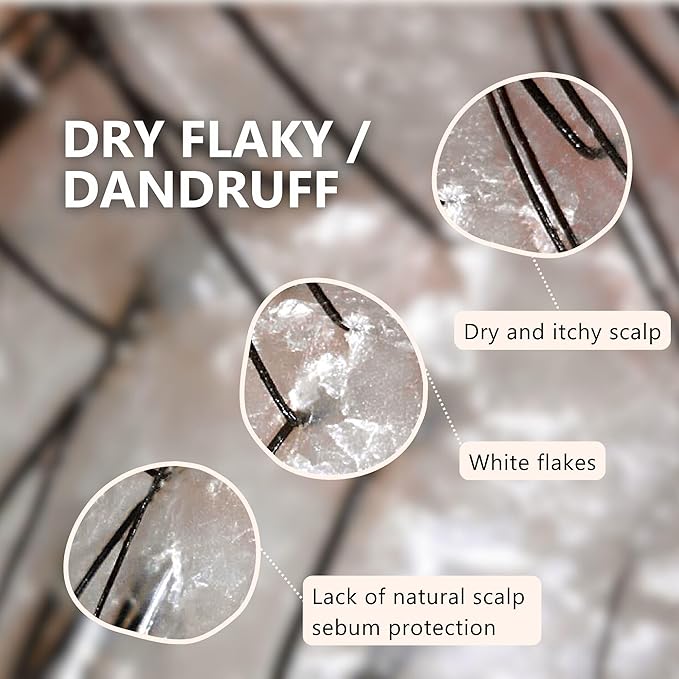 Aromase Dry Scalp Soothing Shampoo - Hydrates, Relieves Dryness and Itchiness - Amino Acid-Based Formula - No Parabens, SLS, or Silicone - 14 oz