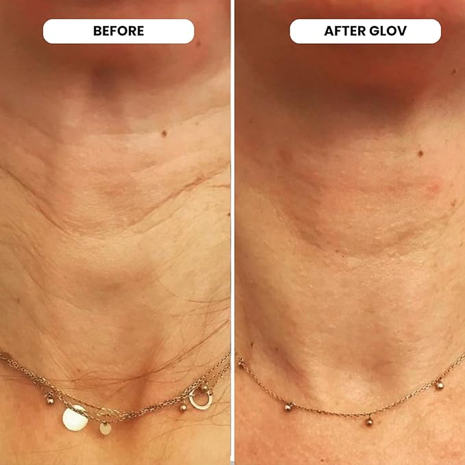 Glov Beauty Micro Infusion System for Face & Lips – 0.25mm 24k Gold Cosmetic Facial Stamp with Hyaluronic Acid, Collagen Peptides & Licorice Root Serum Ampoules (4x Infusion Application, 12x Serums)