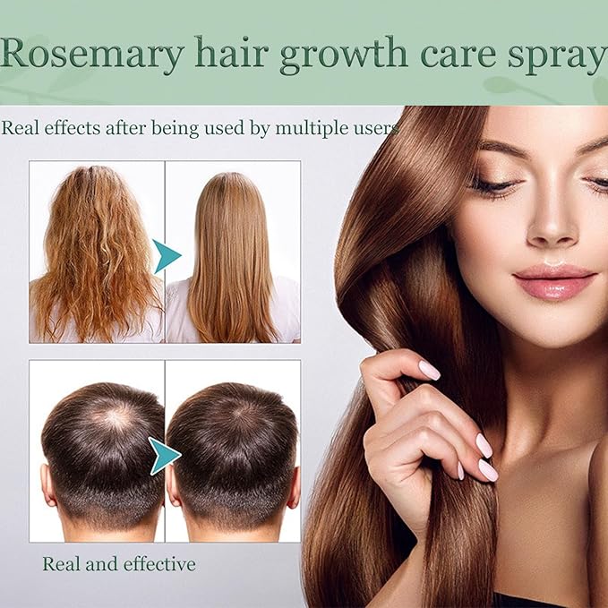 Natural Hair Growth Oil Spray:Rosemary Castor Batana Oil & Rice Water Lotion for Hair Growth ，Promotes Fuller Follicles for Women & Men – All Hair Type