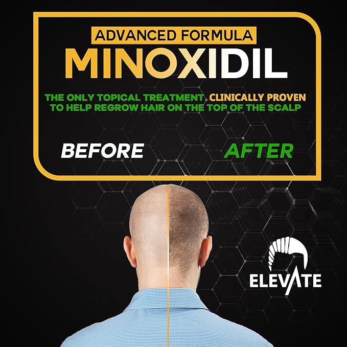 Elevate Hair Regrowth Treatment 5% Minoxidil Spray - Extra Strength Formula Professional Treatment for Hair Loss and Thinning for Regrowth - Stimulate Follicles for Men and Women 1 Month Supply