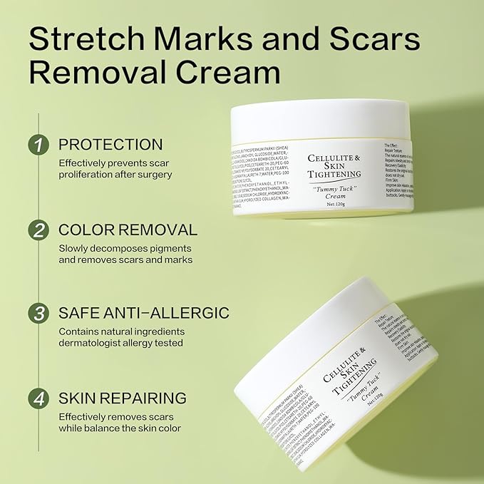 Stretch Marks Removal Cream for Pregnancy Massages Body & Reduces Scar Appearance,Gentle Stretch Marks Eradication Body Skincare Firming (120g/4.23oz)