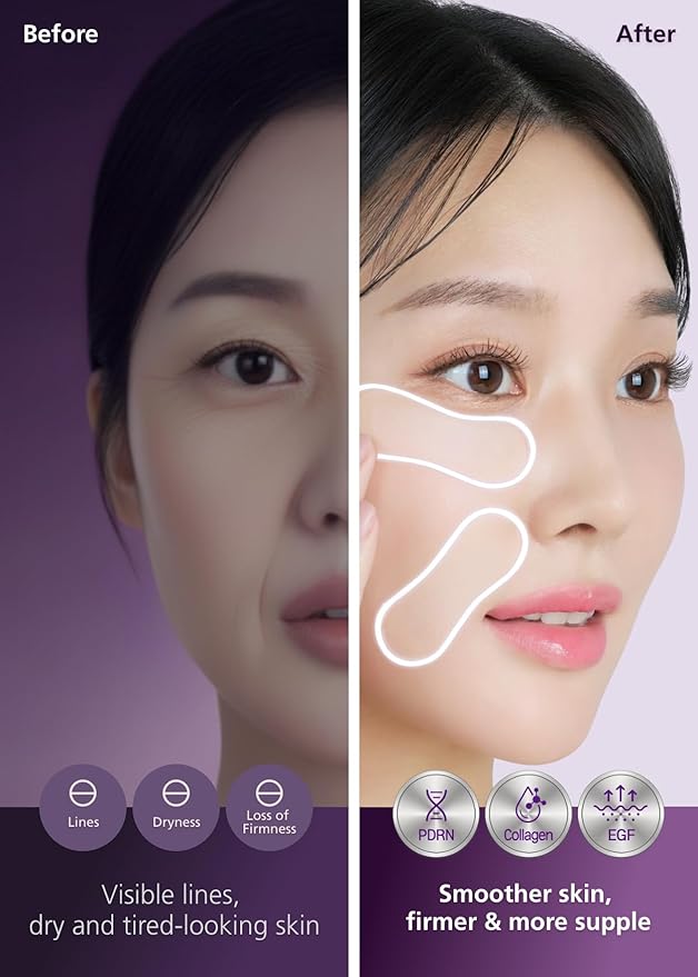 Easyderm PDRN Pimple Patch - Under Eye & Smile Line treatment, 8 Patches, K-Beauty Korean Skincare with Collagen & EGF, Eye patches, PDRN Eye Mask, Stocking Stuffer, Holiday Gift