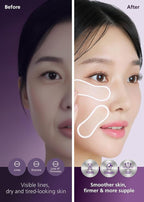 Easyderm PDRN Patch - Under Eye & Smile Line Care, 4 Patches, K-Beauty Korean Skincare with Collagen & EGF, Smile lines treatment, PDRN Eye mask, Special care, Stocking Stuffer Holiday Gift