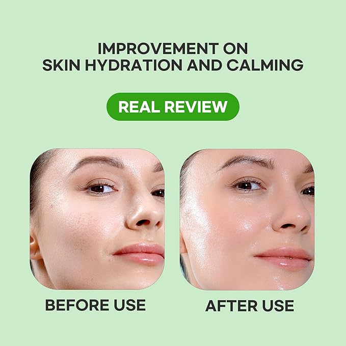 Epielle Cucumber Hydrating Serum Sheet Masks (5pk) | Korean Skincare | Facial Sheet Mask | Kbeauty, Spa Gifts for Women