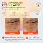 Fig.1 Triple Action Vitamin C Eye Cream Refill | Anti Aging Under Eye Cream for Dark Circles, Puffiness & Wrinkles | Vitamin C + Caffeine to Glow & Refresh Tired Eyes | Fragrance-Free, Refillable