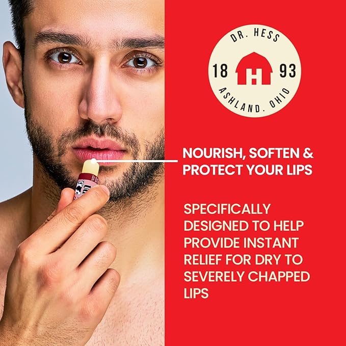 Dr. Hess Original Udder Stick SPF Lip Balm, Soothing Moisturizer Sun Screen Balm for Dry Lips with Jojoba, Beeswax & Shea Butter, Total Lip Care, Hydration & Repair, Cherry Flavor, 4 Pack