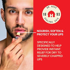 Dr. Hess Original Udder Stick SPF Lip Balm, Soothing Moisturizer Sun Screen Balm for Dry Lips with Jojoba, Beeswax & Shea Butter, Total Lip Care, Hydration & Repair, Cherry Flavor, 4 Pack