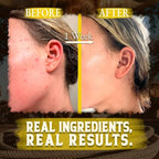 Organic Beef Tallow for Skin - 4 OZ (Citrus) — Grass Fed Beef Tallow for face + Body — US-Made Whipped Tallow and Honey Balm Moisturizer for Dry and Sensitive Skin, Eczema, Rosacea (No Additives)