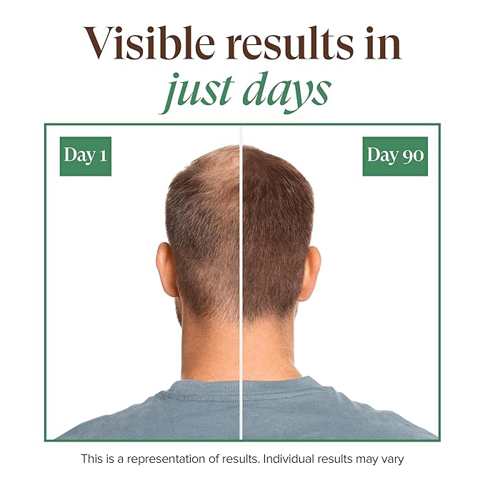 Kreyol Essence - Save Our Scalp Serum (S.O.S Serum) - Redensyl + Haitian Black Castor oil, Fuller Looking Hair, Cold Pressed Castor Oil, Natural Ingredients 1.7 oz