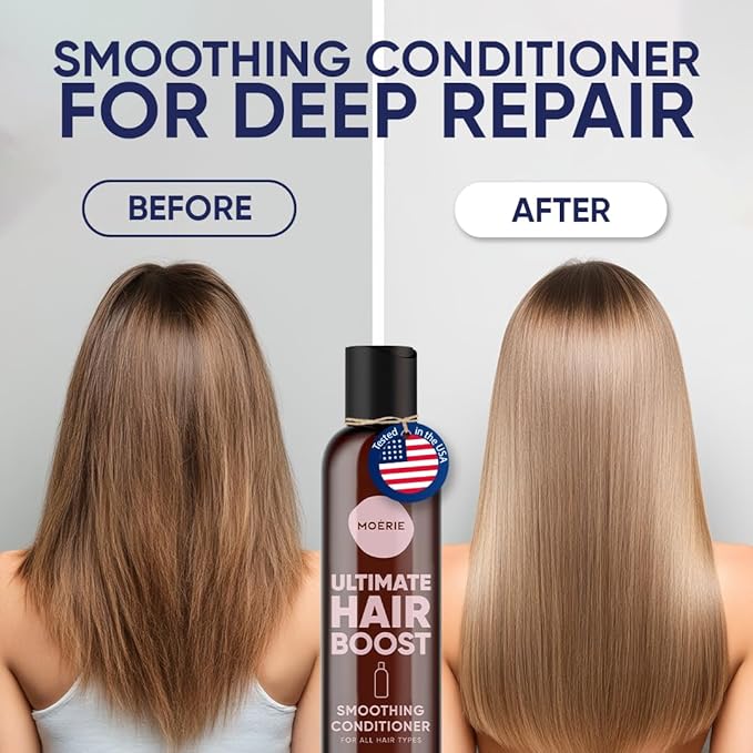 Moerie Ultimate Hair Growth Conditioner – For Longer, Thicker, Fuller Hair - Vegan Friendly Volumizing Hair Products – Paraben & Silicone Free – All Hair Types – Reverse Hair Loss – 8.45 fl oz (250ml)