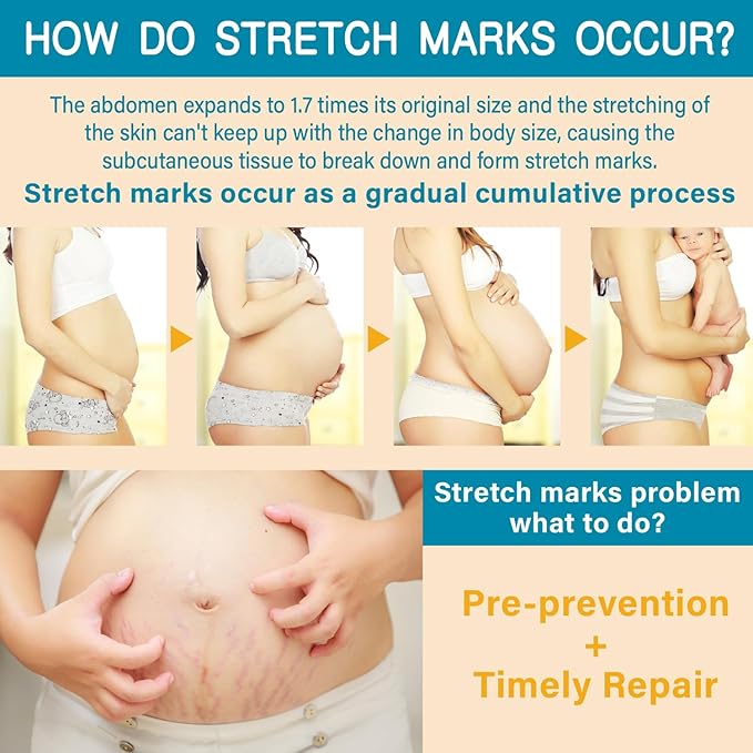 PEGO Stretch Mark Oil for Pregnancy, Maternity Body Oil for Stretch Mark Prevention & Reduction, Hydrating Skin Care, 4.06oz (2Pack)