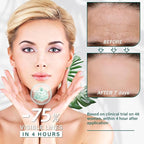 12 Pcs Reusable Silicone Pads for Forehead, Chest & Eye, Anti Wrinkle Patches to Smooth Fine Lines, Chest Wrinkle Pads & Anti Aging Face Silicone Patches for Women