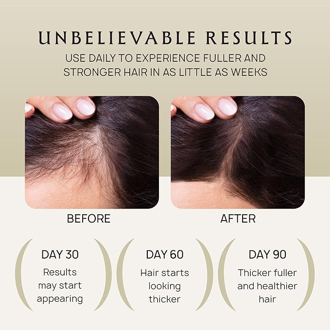 Hair Growth Oil Spray - 100% Pure Ingredients For Non Greasy, Thicker & Stronger Hair - Organic Batana, Castor, Biotin, Saw Palmetto, and Rosemary Oil Gifts for Men & Women Scalp - 4.1 Fl Oz