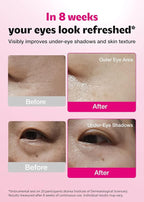 ISOI Blemish Care Under Eye Patch for Dark Circles, Puffiness and Wrinkles, Hydrating Gel Eye Masks with Hyaluronic Acid & Bulgarian Rose Oil, Korean Skin Care (90 pcs, 3.17 oz)