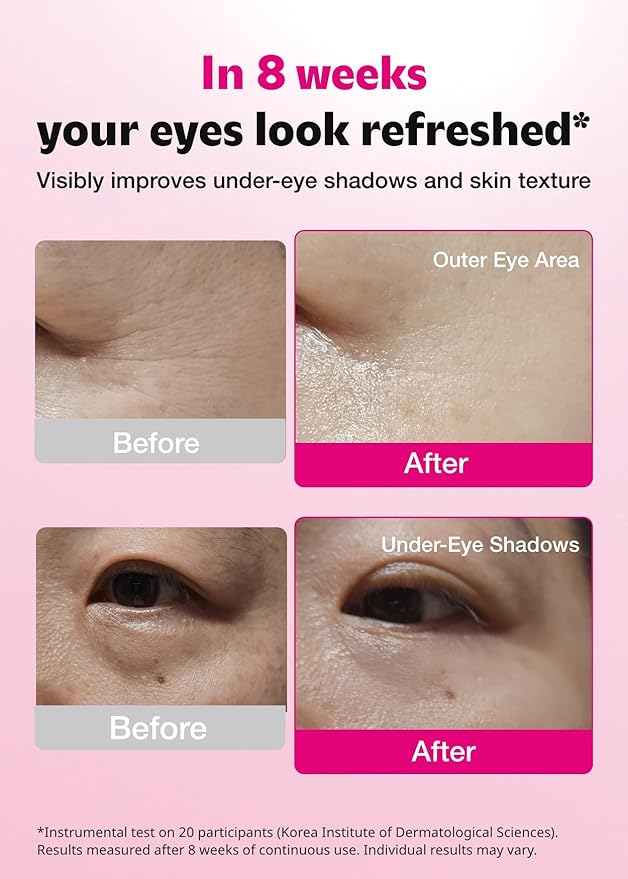 ISOI Blemish Care Under Eye Patch for Dark Circles, Puffiness and Wrinkles, Hydrating Gel Eye Masks with Hyaluronic Acid & Bulgarian Rose Oil, Korean Skin Care (90 pcs, 3.17 oz)