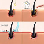 ALFHEIM Rosemary+ Pre-Wash Scalp Oil – Purifying Hair Oil – Hair Treatment and Scalp Clarifying Oil Made with Rosemary Extract – Lightweight Smoothing & Balancing Treatment – Silicone Free – 3.38 oz