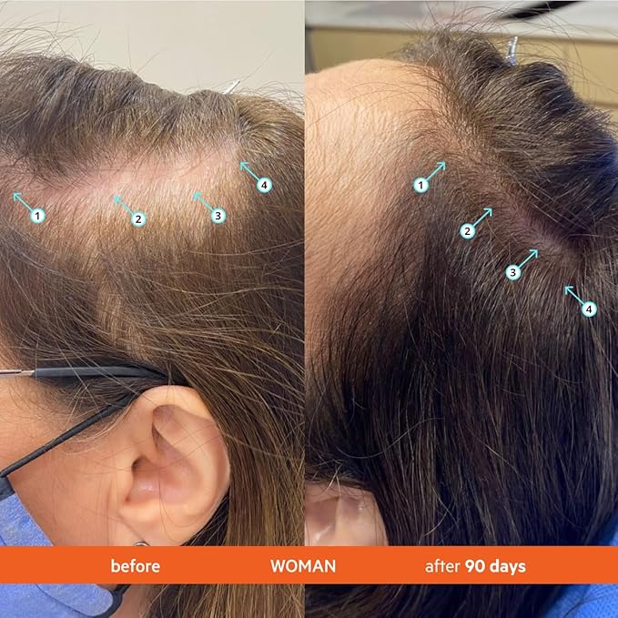 DS Labs Revita Shampoo, 205 mL – Scalp Refreshing Cleanse for Fuller Looking, Volumizing, Lightweight Hydration, Sulfate & Silicone Free, Color Safe, For Men & Women, 2 Pack