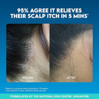 Suu Balm Dry Scalp Treatment, Rapid Itch Relief Anti-Dandruff Scalp Spray Moisturizer, Cooling Itchy Scalp Treatment for Flaky Sensitive & Psoriasis, Cooling Menthol & 5 Ceramides, 1.35 fl oz