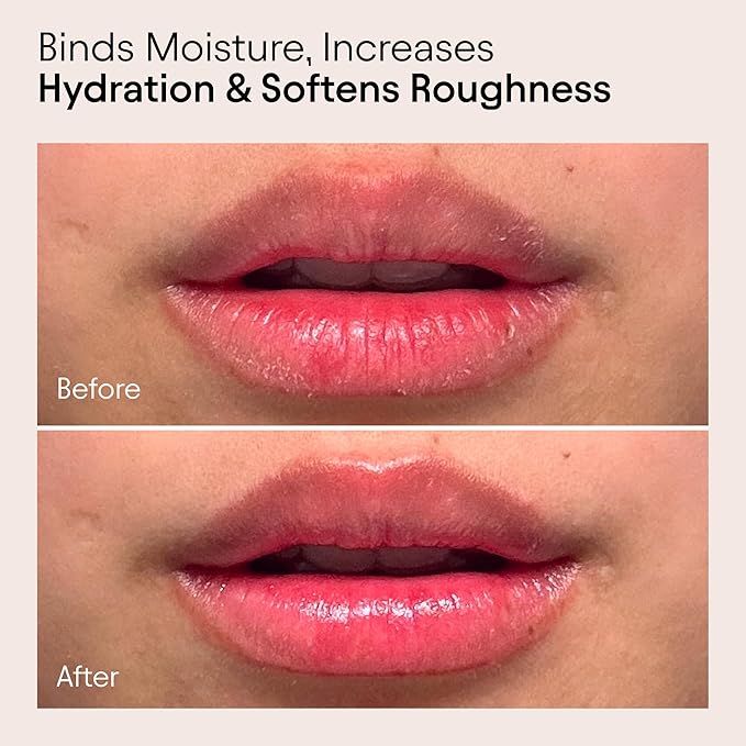 Alpyn Plump Perfectors Limited Edition Set: 1.7 Fl Oz Barrier Cream +0.5 oz Plumping Lip Mask