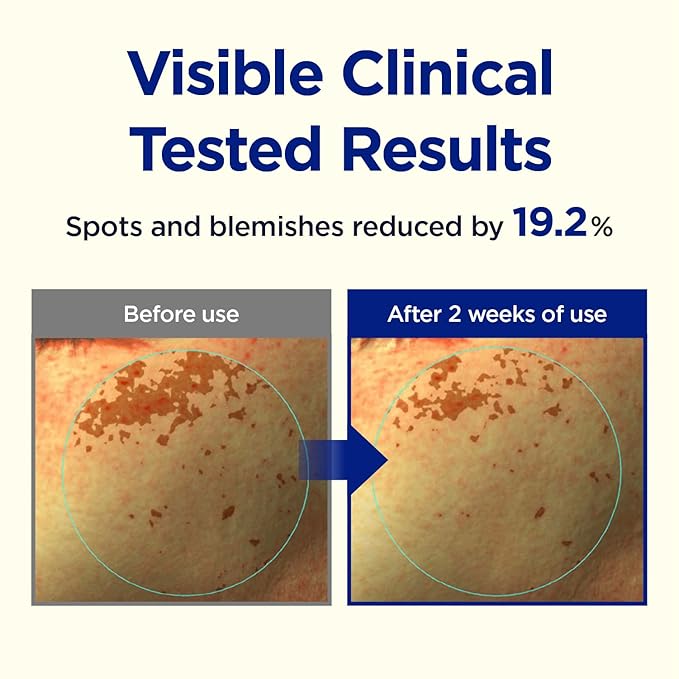 CKD Triple Blemish Under Eye Gel Patch 60 Counts - Hydrogel Spot Treatment, Gentle Formula for Blemish Improvement, Even Tone and Minimize Puffiness with 99% Pure Vitamin C and Teca.