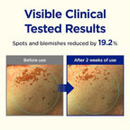 CKD Triple Blemish Under Eye Gel Patch 60 Counts - Hydrogel Spot Treatment, Gentle Formula for Blemish Improvement, Even Tone and Minimize Puffiness with 99% Pure Vitamin C and Teca.