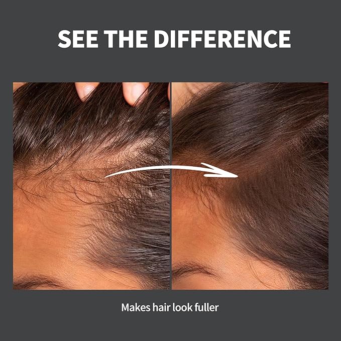 Hairline Powder 24H Stain-Proof, Root Touch Up Hair Color for Gray Coverage,Bald Spot Concealing Hair Shadow Powder for Women & Men,Natural-Looking (Dark Brown)