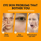 2 PCS Turmeric Retinol Eye Stick,Eye Balm Stick Hydrating for Dark Circle,Wrinkles,Visible Results in 3-4 Weeks,Anti Aging Under Eye,Retinol Eye Cream For Puffiness and Bags Reduces Fine Lines