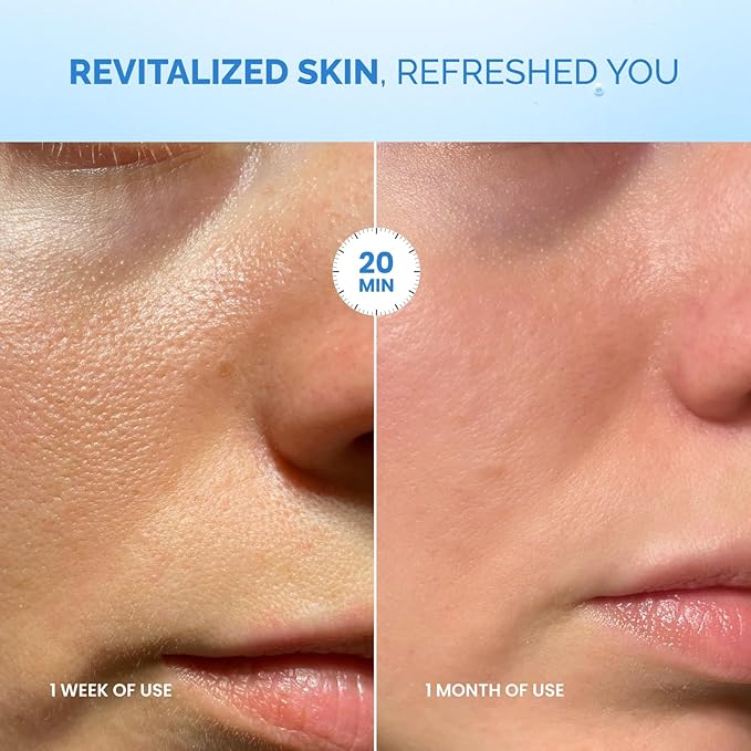 PLANTIFIQUE Facial Sheet Mask Coco Dew 5 Pack – Moisturizing Face Mask with Coconut & Ceramide – Radiant Skin Nourishing Korean Skincare Pack for All Skin Types