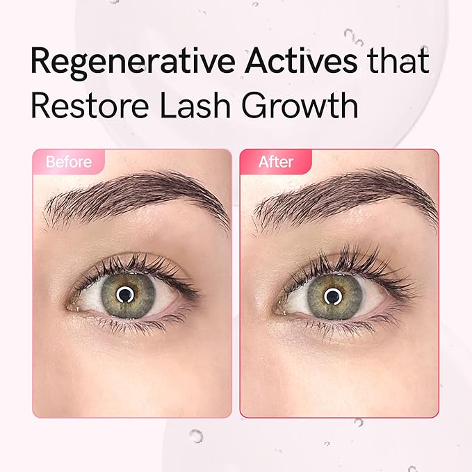 Advanced Lash Repair Serum for Damaged or Extension-Weakened Lashes | PDRN & EGF Recovery Formula with Peptides & Amino Acids | Gentle Korean Lash & Brow Serum, Prostaglandin-Free (0.3 fl oz)