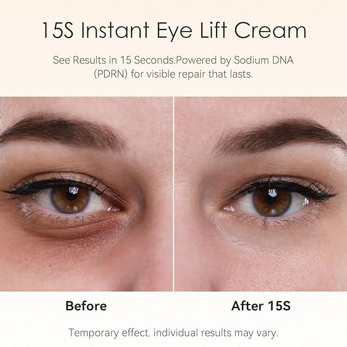15-Second Instant Eye Lift Cream with Sodium DNA & 0.1% Retinal | Rapid Tightening for Eye Bags & Fine Lines | Dual-Action Firming + Long-Term Repair | Caffeine, Peptides & Collagen Complex | 0.7fl oz