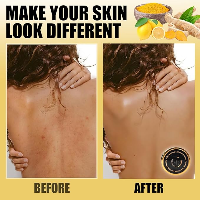 (29) Foaming Body Scrub Turmeric & Lemon – Glow Exfoliating Body Scrub - All Skin Types & Sensitive Skin –Natural Exfoliating Scrub with Oils Revitalization & Brightened (280g)