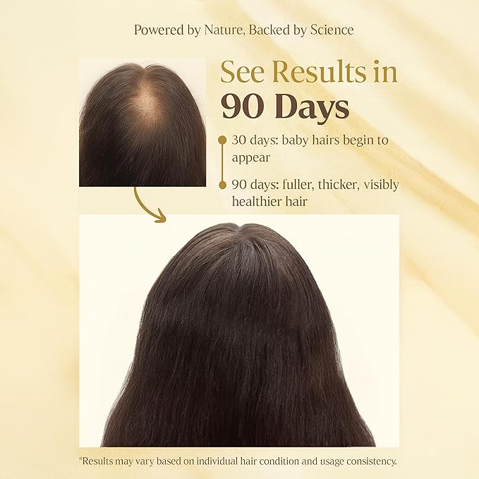 D'Cherlane Hair Growth Oil – Scalp Treatment with Rosemary, Argan, Coconut & Castor Oil Organic | Lightweight, Non-Greasy Formula for Fuller, Thicker, Stronger Strands | For All Hair Types