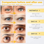 24k Gold Under Eye Patches, Eye Masks for Puffy Eyes 60 pcs, for Dark Circles and Puffiness, Hydrating Eye Mask Skincare, Eye Gel Pads for Eye Bags and Wrinkles Under Eye Treatment