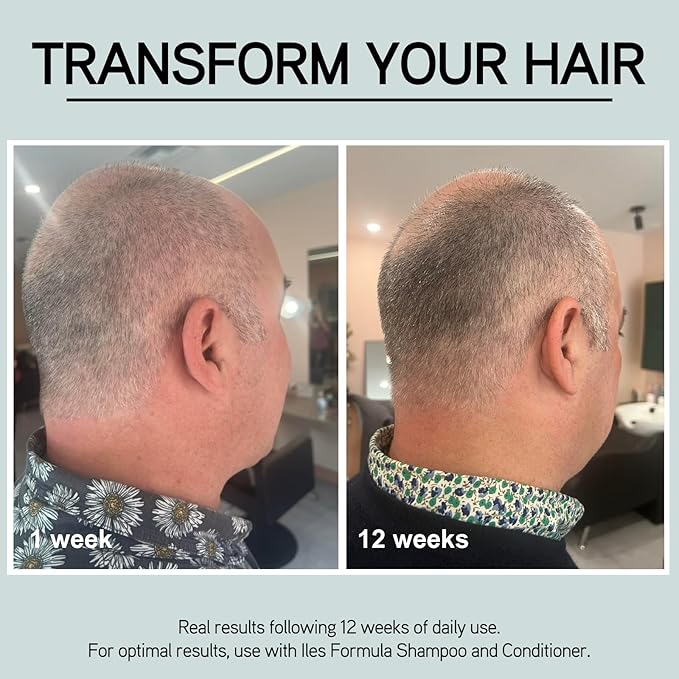 ILES FORMULA Grey Delay Anti Gray Hair Booster – Botanical Leave-In Treatment Spray with Silverfree and Melanogray to Restore Natural Hair Color and Prevent Premature Greying, 1-Month Supply