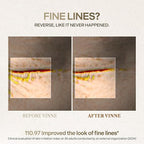 VINNE Signature Bio Deep Collagen Firming Mask – Korean Hydrogel Mask w/ 5,000ppm Ultra-Low Molecular Collagen, Centella Asiatica Exosome, Niacinamide & PDRN – Skin Care Face Mask (4 Sheets, 1.41 oz)