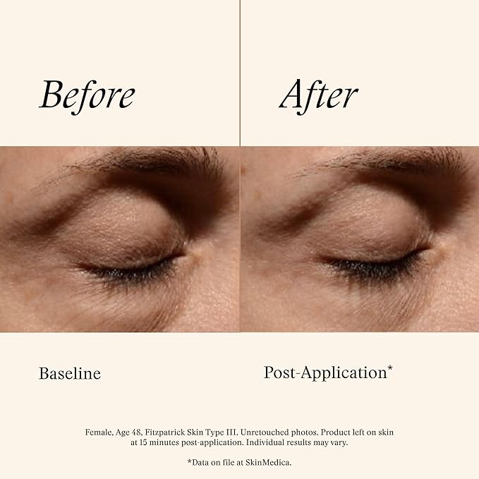 SkinMedica Instant Bright Eye Cream - Our Age-Defying Under the Eye Cream Instantly Improves Eyes’ Appearance, Including Dark Circles, Sagging, Puffiness and Lines, NEW PACKAGING, 0.5 Oz