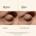 SkinMedica Instant Bright Eye Cream - Our Age-Defying Under the Eye Cream Instantly Improves Eyes’ Appearance, Including Dark Circles, Sagging, Puffiness and Lines, NEW PACKAGING, 0.5 Oz