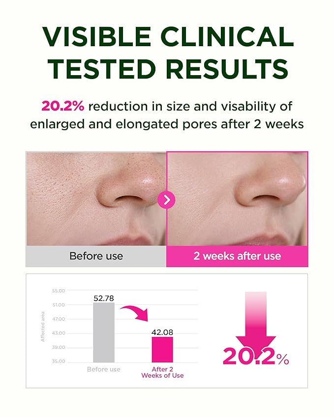 CKD Pore-Tightening & Firming Face Mask (1ea) – Korean Hydrogel Sheet Mask for Glass Skin, Minimizes Pores & Boosts Firmness with 3rd Retinal & Low Molecular Collagen, Korean Skincare