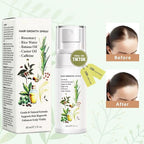 Natural Hair Growth Oil Spray:Rosemary Castor Batana Oil & Rice Water Lotion for Hair Growth ，Promotes Fuller Follicles for Women & Men – All Hair Type