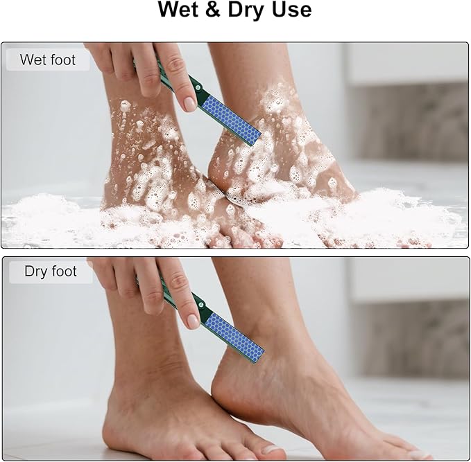 2-in-1 Stainless Steel Foot File & Callus Remover - Dual-Sided Pedicure Scrubber Tool, Hard Dead Skin & Corn Removal, Hygienic Durable Foot Rasp for Soft Smooth Feet (Dark Green)