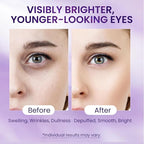 Caffeine & Retinol Under Eye Serum – Dermatologist-Tested, Fast Absorbing, Correction for Puffy Eye Bags Fine Lines Dark Circles Wrinkles While Providing Moisturizing Care